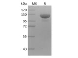 Recombinant Human Receptor Tyrosine-Protein Kinase ErbB-3/HER3 (C-mFc) - ABMIUM