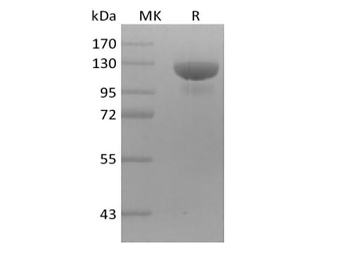 Recombinant Human Receptor Tyrosine-Protein Kinase ErbB-3/HER3 (C-mFc) - ABMIUM