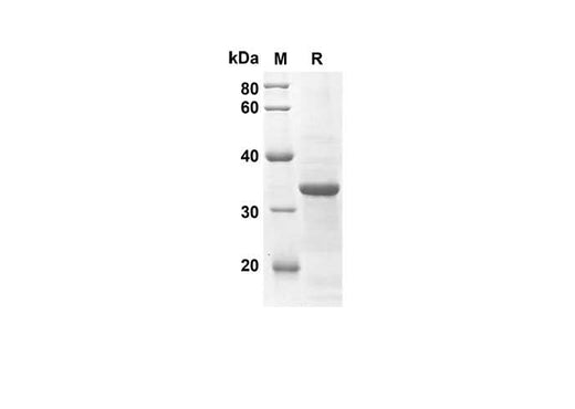 SDS-PAGE analysis of Mouse Ccl25 proteins, 2 μg/lane of Recombinant Mouse Ccl25 proteins was resolved with an SDS-PAGE under reducing conditions, showing bands at 26.2 kDa.