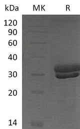 Recombinant Mouse Kallikrein 7/KLK7 Protein (His Tag) - ABMIUM