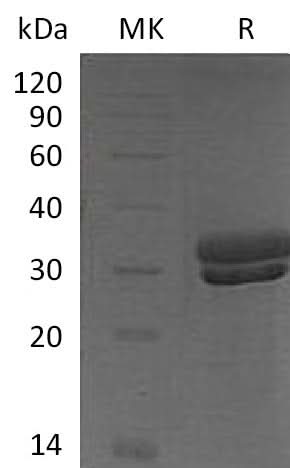 Recombinant Mouse Kallikrein 7/KLK7 Protein (His Tag) - ABMIUM