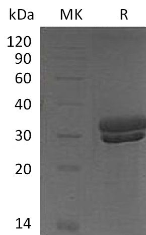 Recombinant Mouse Kallikrein 7/KLK7 Protein (His Tag) - ABMIUM