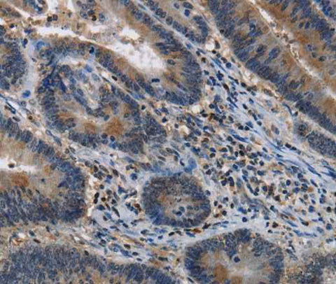 Anti-Human ITPR2 Antibody