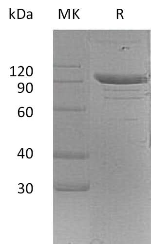 Recombinant Mouse PSGL-1/CD162 Protein (aa 42-307, Fc Tag) - ABMIUM