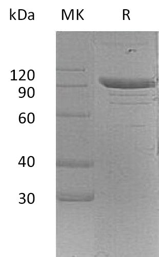 Recombinant Mouse PSGL-1/CD162 Protein (aa 42-307, Fc Tag) - ABMIUM