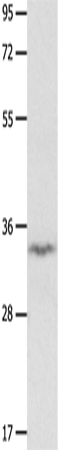 Anti-Human/Mouse IGFBP7 Antibody - ABMIUM