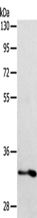 Anti-Human ST2 Antibody - ABMIUM