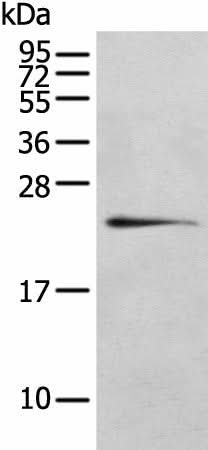 Western blot analysis of 293T cell using RILPL2 Polyclonal Antibody at dilution of 1:400