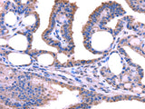 Anti-Human TRIM49 Antibody - ABMIUM