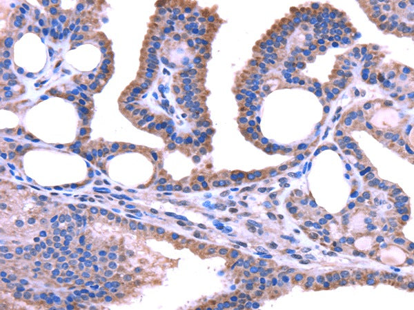 Anti-Human TRIM49 Antibody - ABMIUM