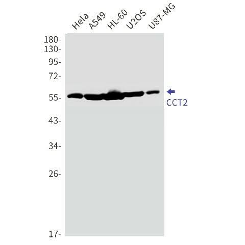 Western blot detection of CCT2 in Hela,A549,HL-60,U2OS,U87-MG cell lysates using CCT2 Rabbit mAb(1:1000 diluted).Predicted band size:57kDa.Observed band size:57kDa.