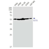Western blot detection of CCT2 in Hela,A549,HL-60,U2OS,U87-MG cell lysates using CCT2 Rabbit mAb(1:1000 diluted).Predicted band size:57kDa.Observed band size:57kDa.
