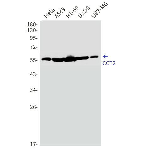 Western blot detection of CCT2 in Hela,A549,HL-60,U2OS,U87-MG cell lysates using CCT2 Rabbit mAb(1:1000 diluted).Predicted band size:57kDa.Observed band size:57kDa.