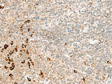 Immunohistochemistry of paraffin-embedded Human tonsil tissue using RMND5A Polyclonal Antibody at dilution of 1:50(×200)