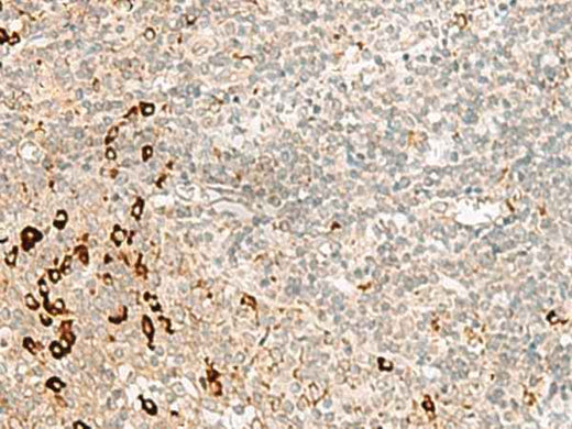 Anti-Human/Mouse RMND5A Antibody