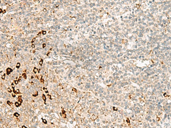 Immunohistochemistry of paraffin-embedded Human tonsil tissue using RMND5A Polyclonal Antibody at dilution of 1:50(×200)
