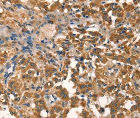 Anti-Human/Mouse AGO1 Antibody