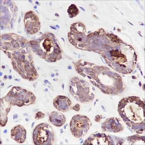 Anti-Human GCDFP-15 Antibody [A228] - ABMIUM