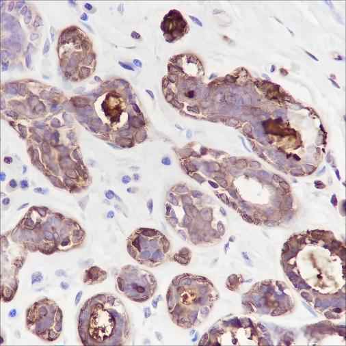 Anti-Human GCDFP-15 Antibody [A228] - ABMIUM