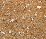 Anti-Human AKAP12 Antibody - ABMIUM