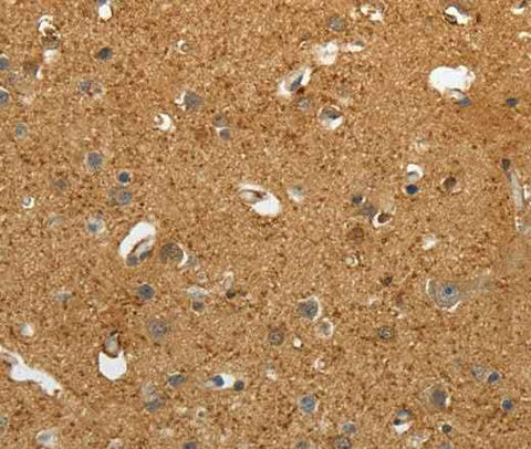 Anti-Human AKAP12 Antibody