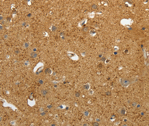 Anti-Human AKAP12 Antibody - ABMIUM