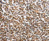 Anti-Human/Mouse IRAK3 Antibody - ABMIUM
