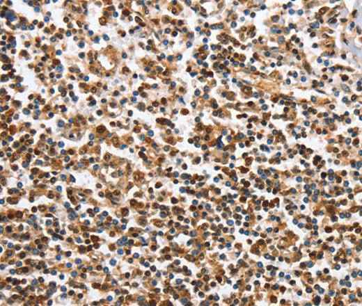 Anti-Human/Mouse IRAK3 Antibody