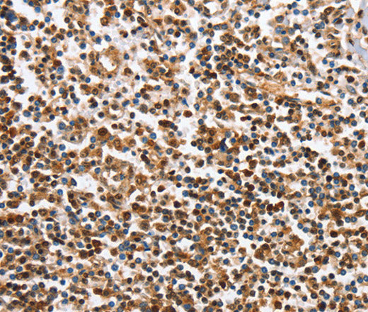 Anti-Human/Mouse IRAK3 Antibody - ABMIUM