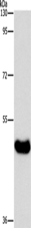 Anti-Human BAAT Antibody - ABMIUM