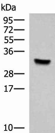 Anti-Human/Mouse/Rat KCTD7 Antibody