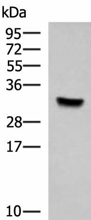 Western blot analysis of Hela cell lysate using KCTD7 Polyclonal Antibody at dilution of 1:1000