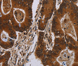 Anti-Human/Mouse DCAF6 Antibody - ABMIUM