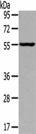 Anti-Human/Mouse/Rat THRA Antibody - ABMIUM