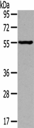 Anti-Human/Mouse/Rat THRA Antibody - ABMIUM