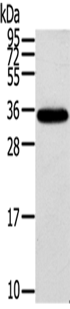 Anti-Human/Mouse KCNMB3 Antibody - ABMIUM