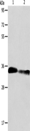 Anti-Human/Mouse ACY3 Antibody - ABMIUM