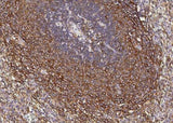 Anti-Human CCR1 Antibody [A1286] - ABMIUM
