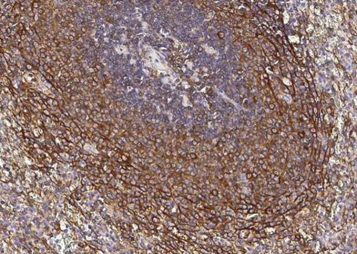 Anti-Human CCR1 Antibody [A1286] - ABMIUM