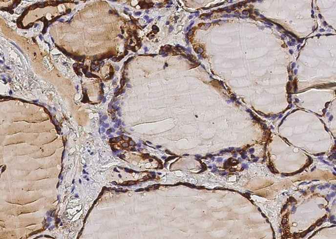Anti-Human TPO Antibody [A1077] - ABMIUM