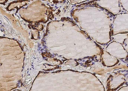 Anti-Human TPO Antibody [A1077] - ABMIUM