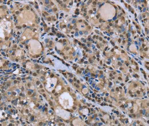 Anti-Human/Mouse/Rat DYNLL1 Antibody