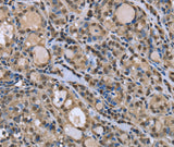 Anti-Human/Mouse/Rat DYNLL1 Antibody - ABMIUM