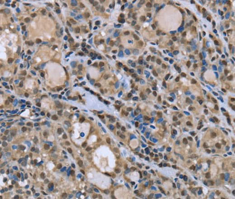 Anti-Human/Mouse/Rat DYNLL1 Antibody - ABMIUM