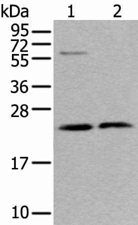 Anti-Human/Mouse/Rat ABHD14B Antibody