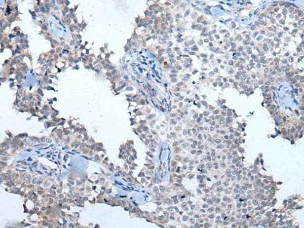 Anti-Human ATM Antibody