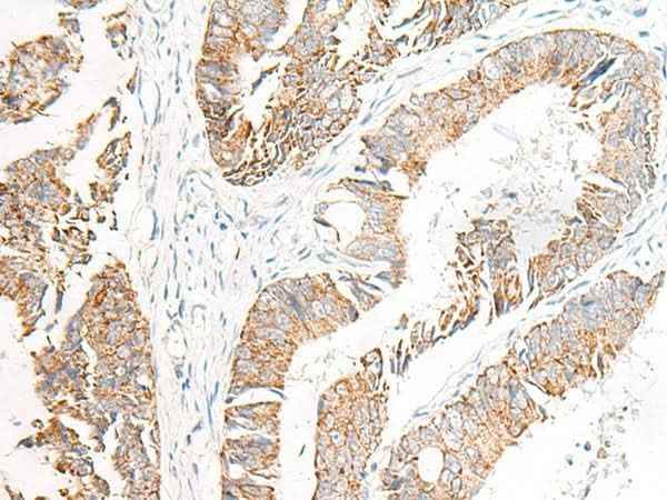 Anti-Human FGR Antibody