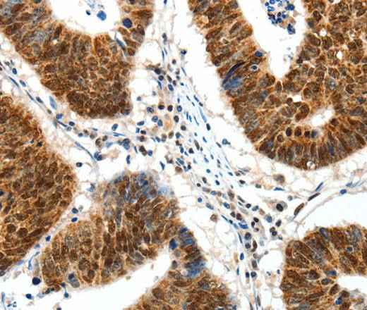 Anti-Human/Mouse/Rat SP1 Antibody