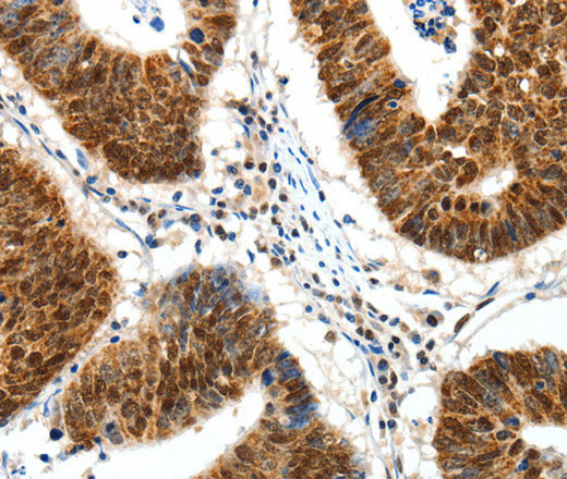 Anti-Human/Mouse/Rat SP1 Antibody - ABMIUM