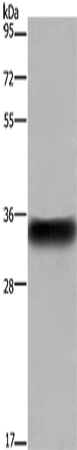 Anti-Human FCGR2B Antibody - ABMIUM